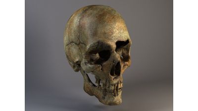 Man Skull Cracked